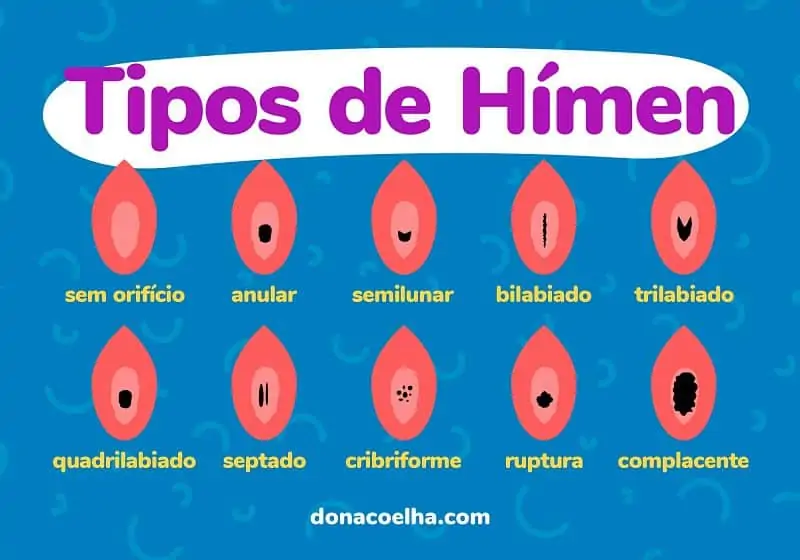 Banner ilustrativo mostrando diversos tipos de hímen a partir de desenhos