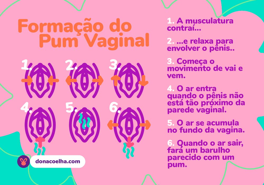 Flato vaginal infográfico