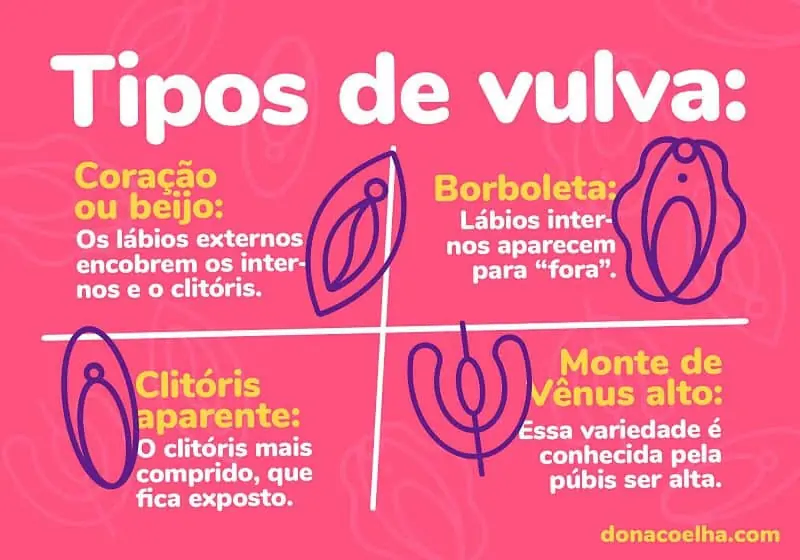 Infográfico mostrando os diversos tipos de vulva